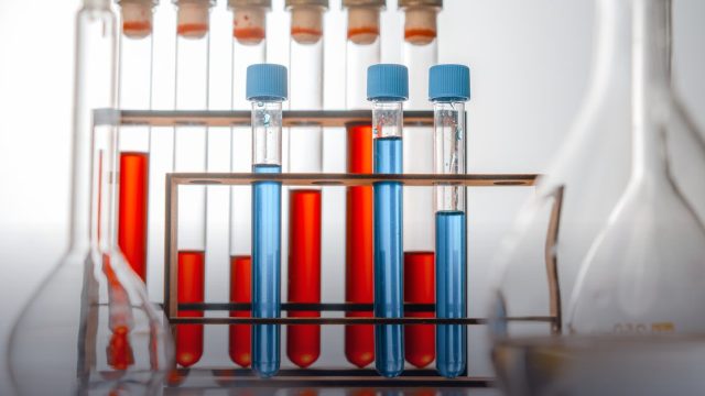 Istanbul 5th World Congress on Green Chemistry, Water Studies & Sustainable Environment (GCWS2E-27)
