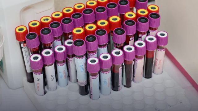 5th Worldwide Conference on Infectious Diseases